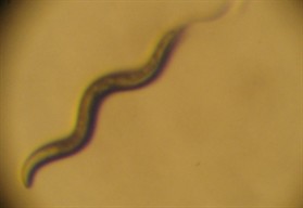 Image of wild type C. elegans